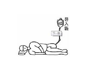 慶源養生大腸水療做法示意圖