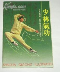 氣功所致精神障礙