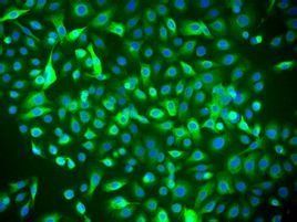蛋白核小球藻 蛋白核小球藻