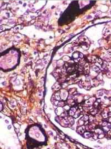 血清總蛋白 血清總蛋白