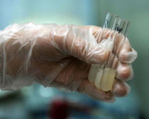 精子活動率 精子活動率