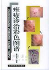 痤瘡診治彩色圖譜 痤瘡診治彩色圖譜