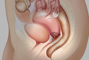 子宮[德國2010年本尼德克·菲利格夫執導電影]