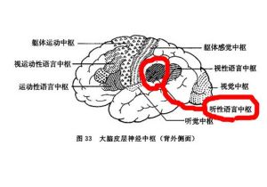 感覺性失語症 感覺性失語症