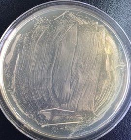 藍白斑篩選 藍白斑篩選