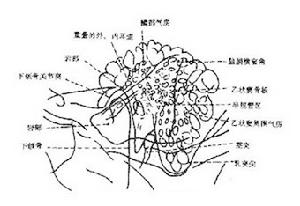 急性化膿性乳突炎