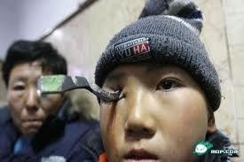 國務院辦公廳關於建立健全基層醫療衛生機構補償機制的意見》