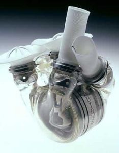 人造心臟 人造心臟