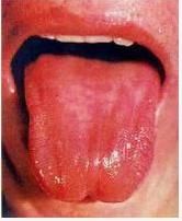鏡面舌