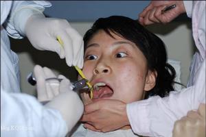 牙醫恐懼症