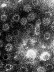 感染性腹瀉 感染性腹瀉