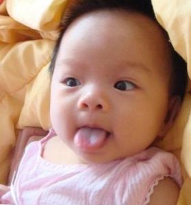 舌苔薄白 舌苔薄白