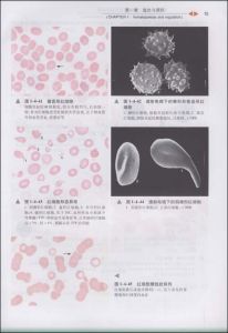 《血液病診斷與鑑別診斷圖譜》