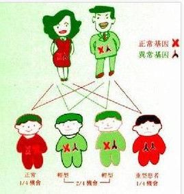 地貧基因 地貧基因