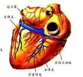 穩定型心絞痛 穩定型心絞痛