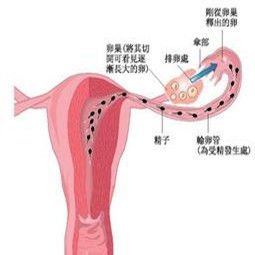 原發性不孕 原發性不孕