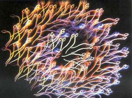 弱精子症 弱精子症