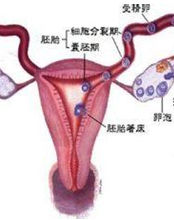 輸卵管造口 輸卵管造口