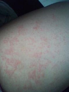 貓癬[電腦病毒]