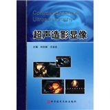 《超聲造影顯像》