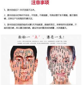 雷射點痣 雷射點痣