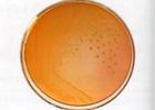 （圖）艱難梭狀芽孢桿菌小腸結腸炎