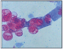 尿腎小管上皮細胞（S染色）