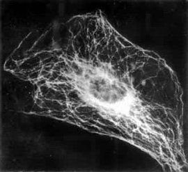 微管組織中心 微管組織中心