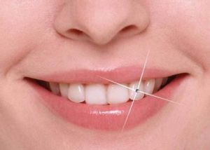 人工種植牙 人工種植牙