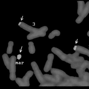 標記染色體 標記染色體
