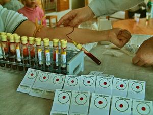 鼻咽癌早期血清化驗