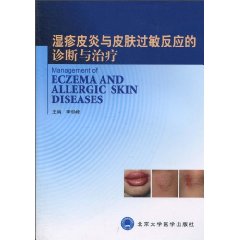 濕疹皮炎與皮膚過敏反應的診斷與治療