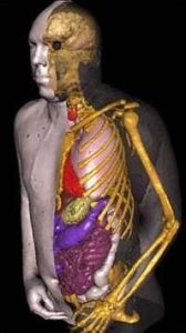 RPI的VIP-MAN模型[11]