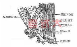 直疝三角 直疝三角