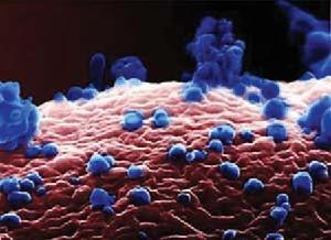 （圖）非典病毒侵襲人體細胞過程圖片