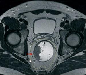固有筋膜 固有筋膜