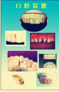 口腔保健 口腔保健