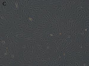 臍帶間充質幹細胞