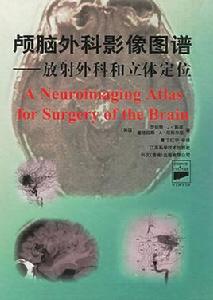 顱腦外科影像圖譜 顱腦外科影像圖譜