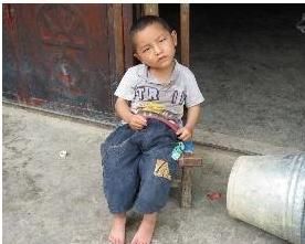 痙攣性腦癱 痙攣性腦癱