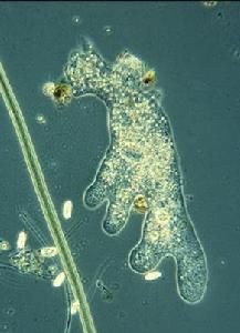 慢性阿米巴痢疾 慢性阿米巴痢疾