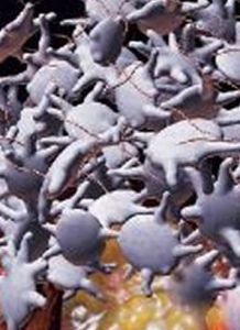 血小板壓積 血小板壓積