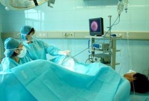 人工流產綜合症 人工流產綜合症