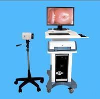 電子陰道鏡 電子陰道鏡