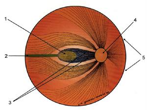 獲得性視網膜劈裂