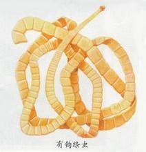 土源性蠕蟲 土源性蠕蟲