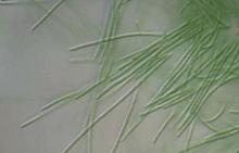 絲狀藍藻