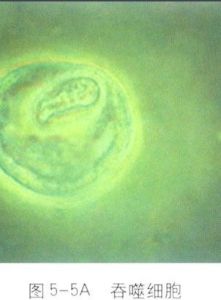 吞噬細胞 吞噬細胞