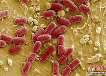 腸出血性大腸桿菌