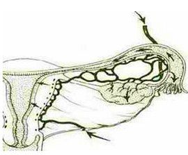 卵巢功能低下 卵巢功能低下